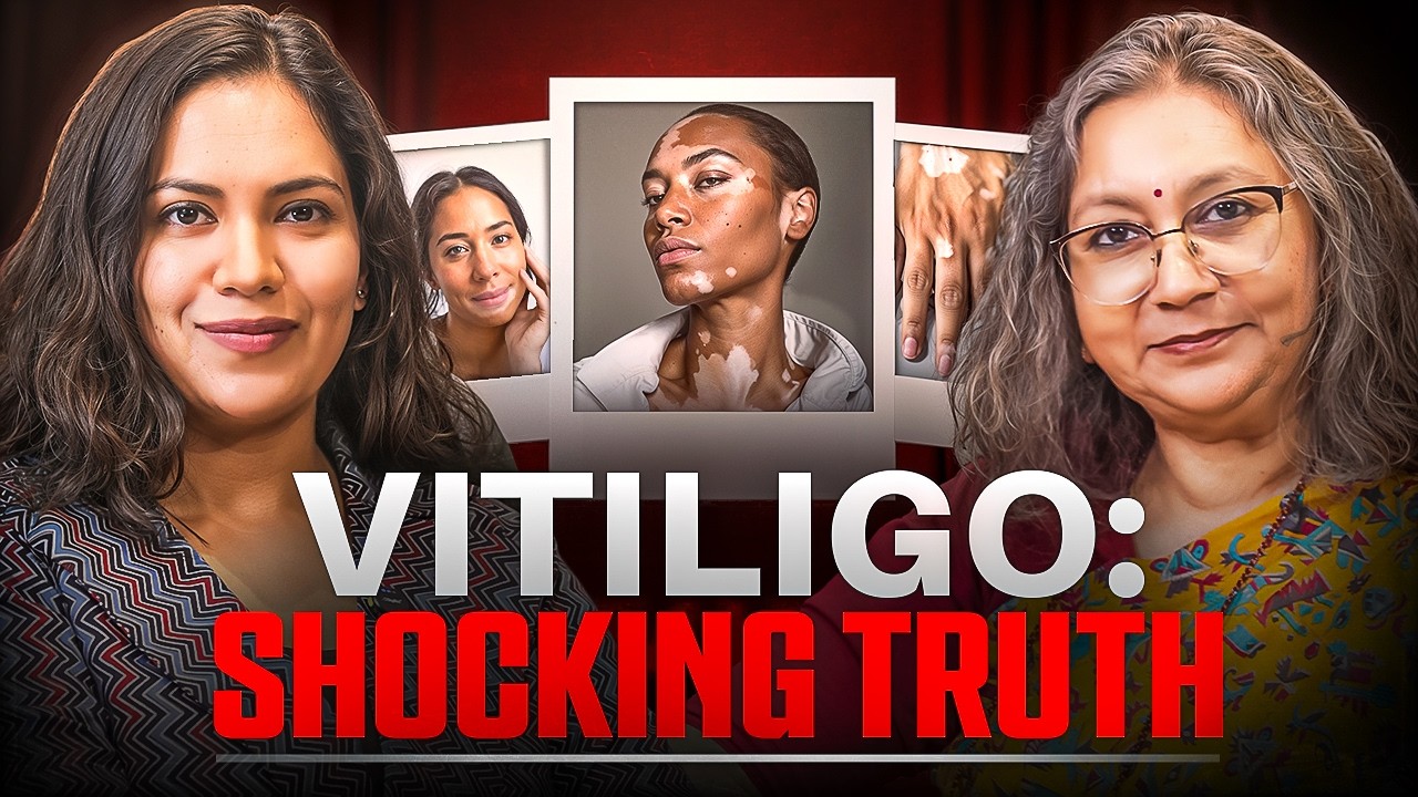 Vitiligo Myths Busted: Real Causes, Treatment & Mental Health | Dr. Kapila Verma & Kakoli Roy
