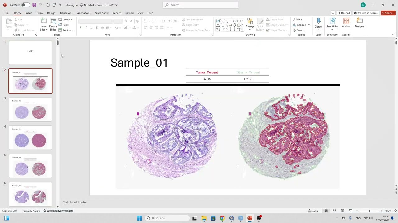 Effortlessly Summarize Image Segmentation Results from QuPath to PowerPoint Using R