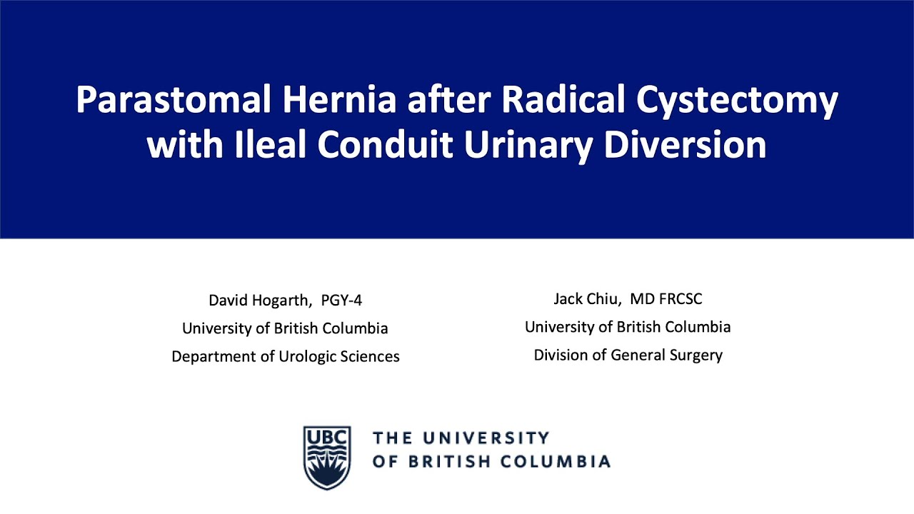 Parastomal Hernia after Radical Cystectomy with Ileal Conduit Urinary Diversion