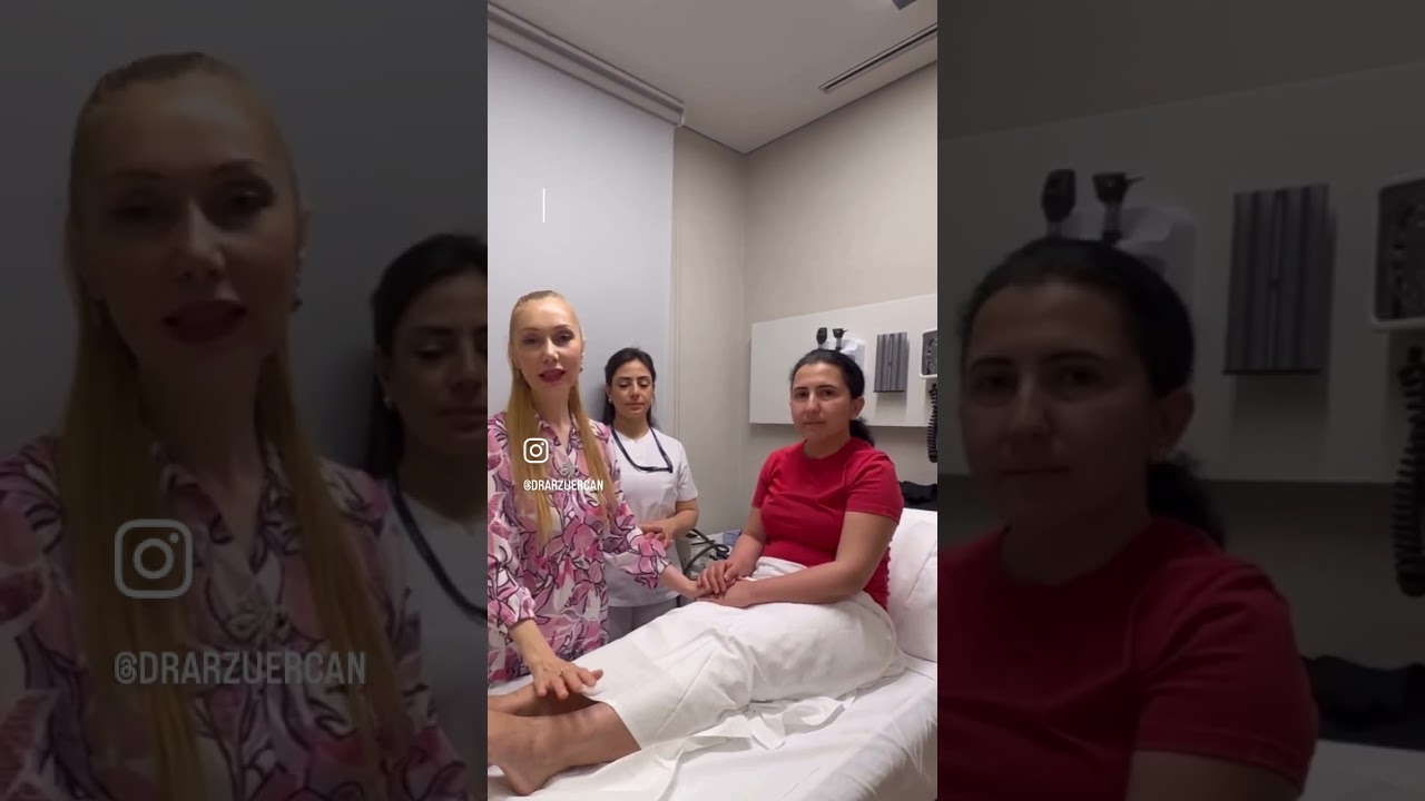 Varis tedavisinde scleroterapi şart mı🧐