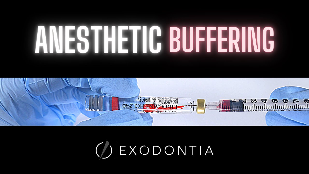 How to Buffer Local Anesthetic | Dental Surgery | Dentistry | OnlineExodontia.com