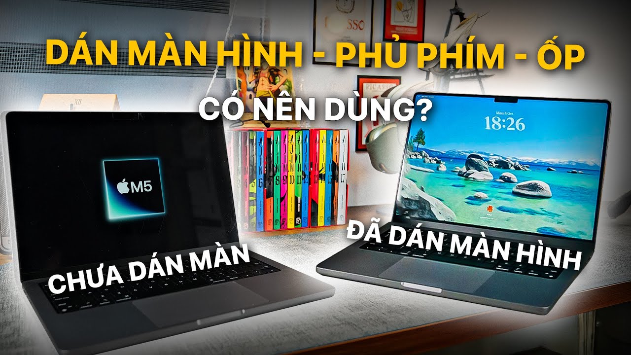 C&Oacute; N&Ecirc;N D&Ugrave;NG PHỤ KIỆN BẢO VỆ MACBOOK?
