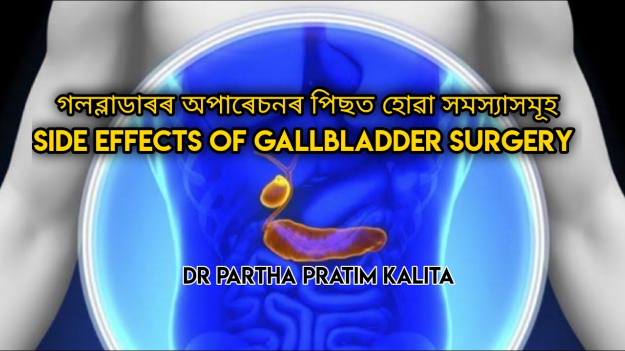 গলব্লাডাৰৰ অপাৰেচনৰ পিছত হোৱা সমস্যাসমূহ ll SIDE EFFECTS OF GALLBLADDER SURGERY ll স্বাস্থ্যবাৰ্তা