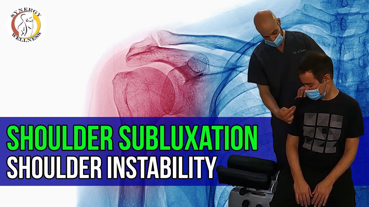 Shoulder Subluxation Shoulder Instability
