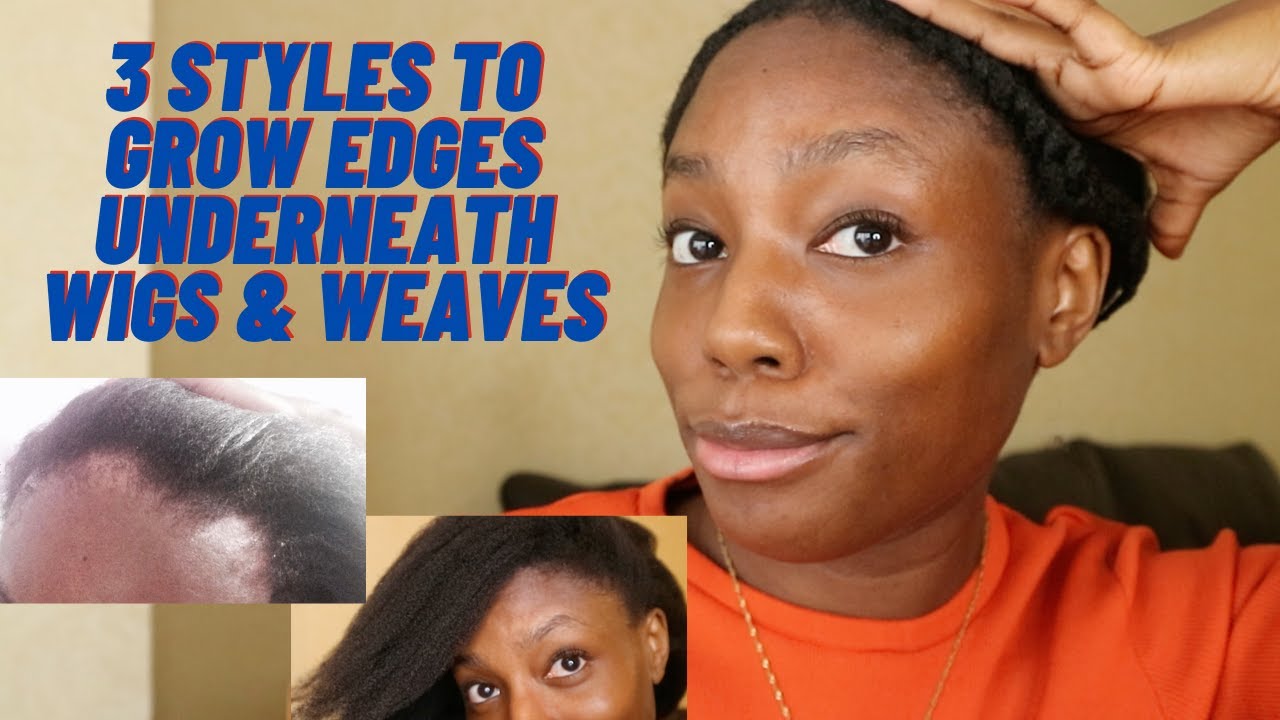 3 Styles to Grow Your Edges Underneath Wigs & Weaves | Traction Alopecia