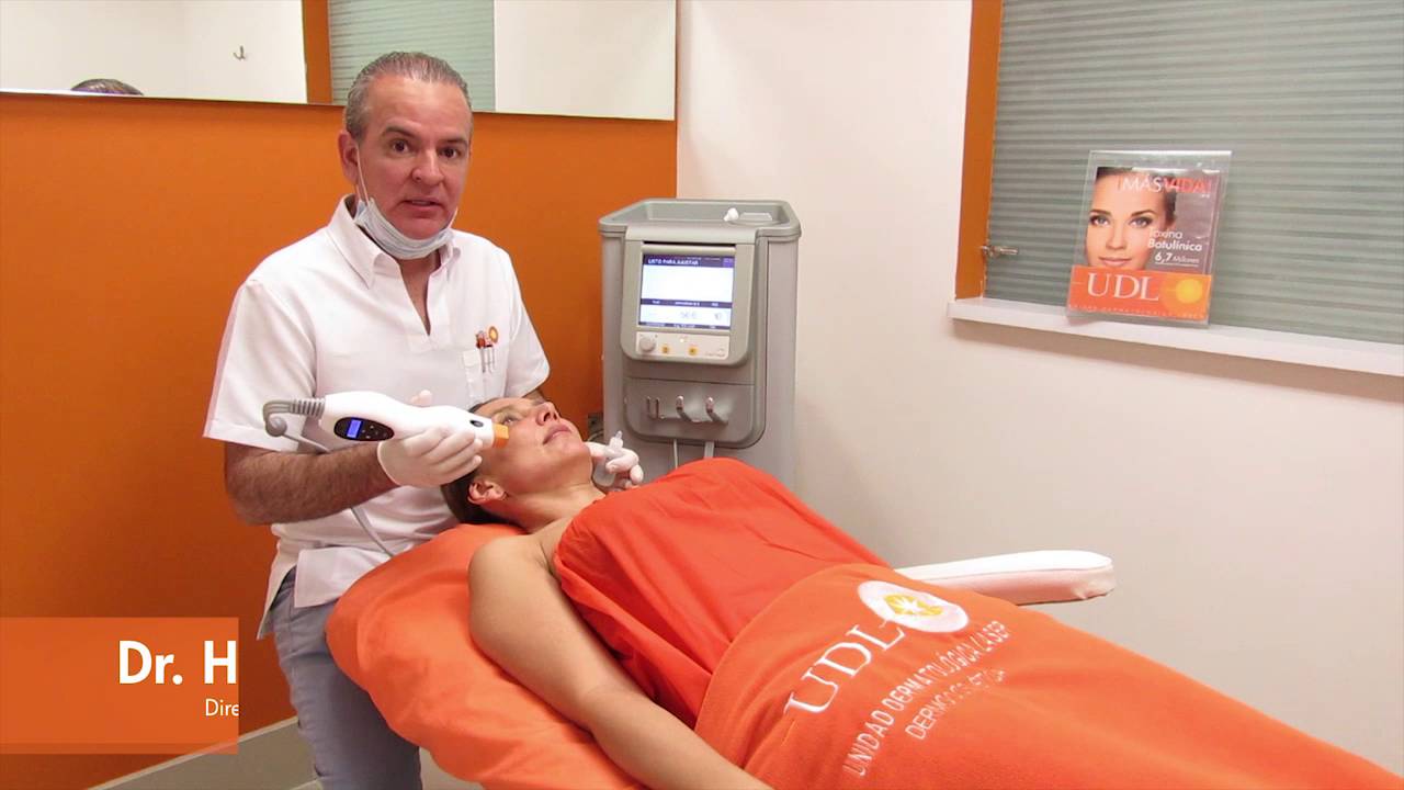 Thermage UDL, la radiofrecuencia #1 para tensar la piel