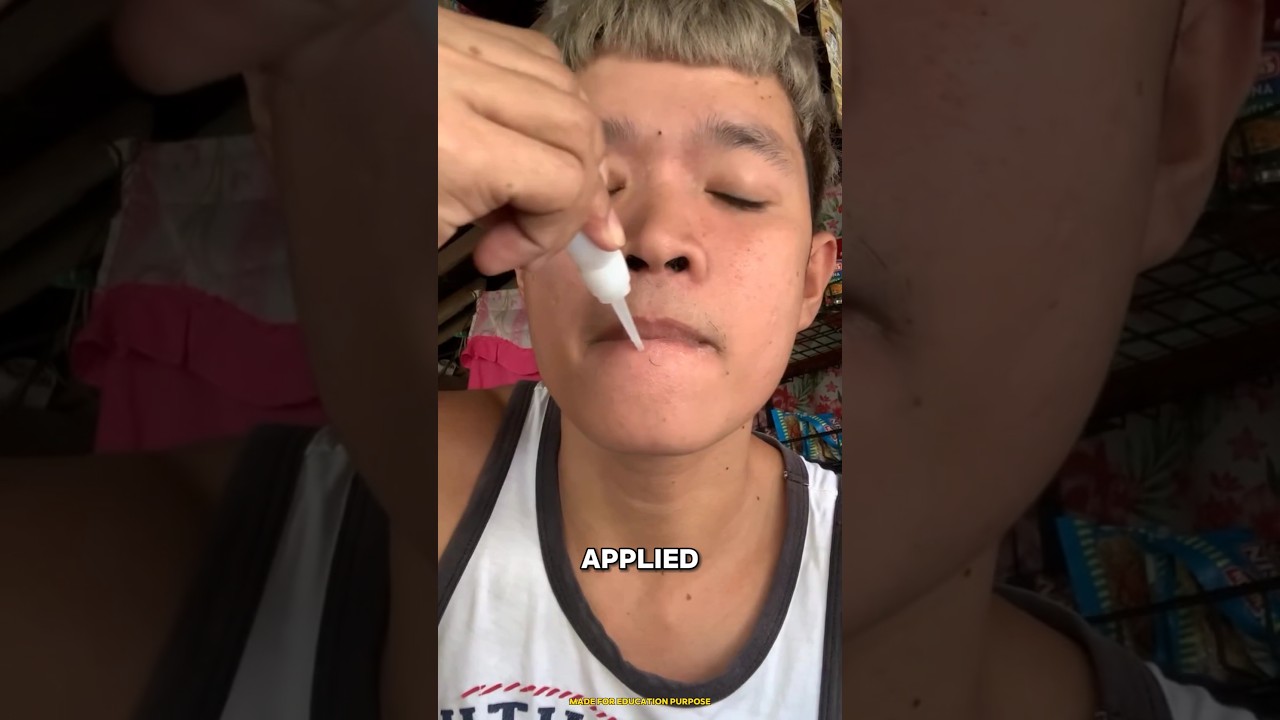 He applied super glue on lips😲
