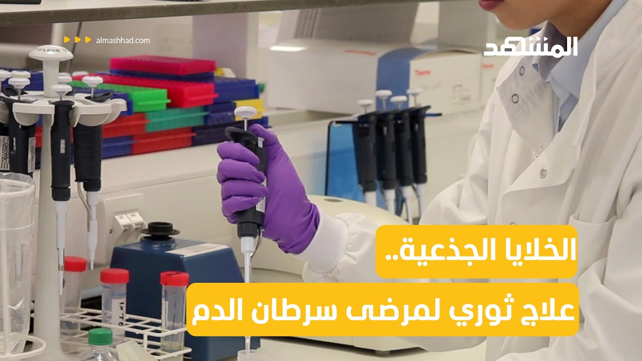 الخلايا الجذعية.. علاج ثوري لمرضى سرطان الدم تصل نسبة الشفاء فيه إلى 90%