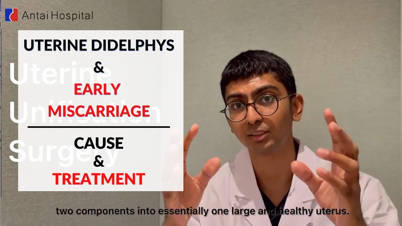 Uterine Didelphys and Early Miscarriage  | Double Uterus | Antai Hospital