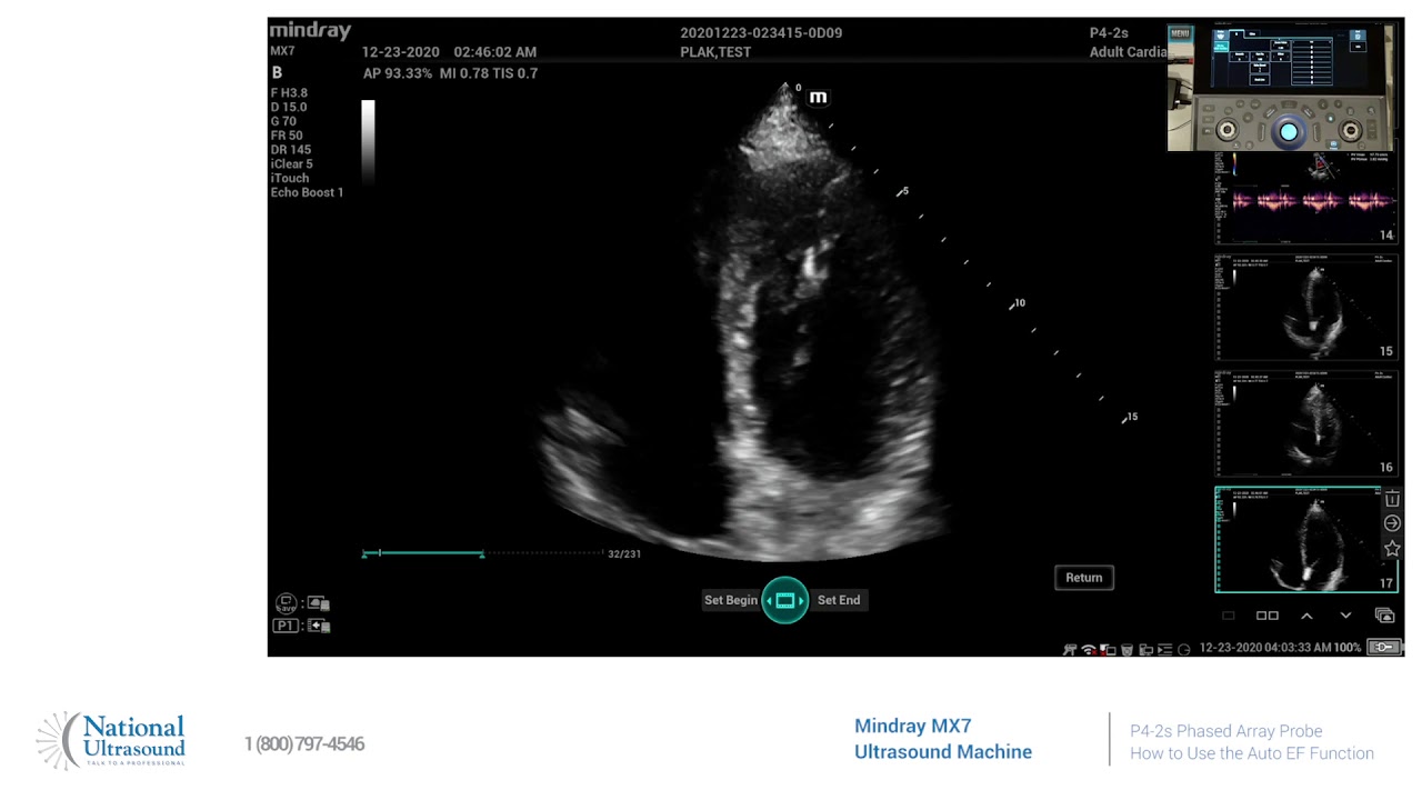How to Use the Auto EF Function on the Mindray MX7 Ultrasound Machine