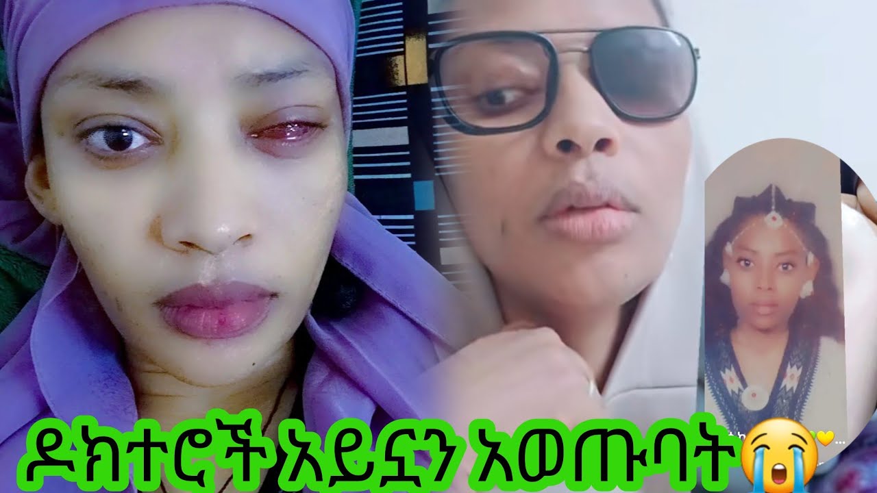ዶክተሮቹ አይኗን አወጡባት😭