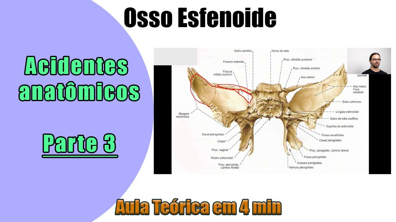 Osso Esfenoide - Aula Teórica 3- Anatomia - Anatomia Humana