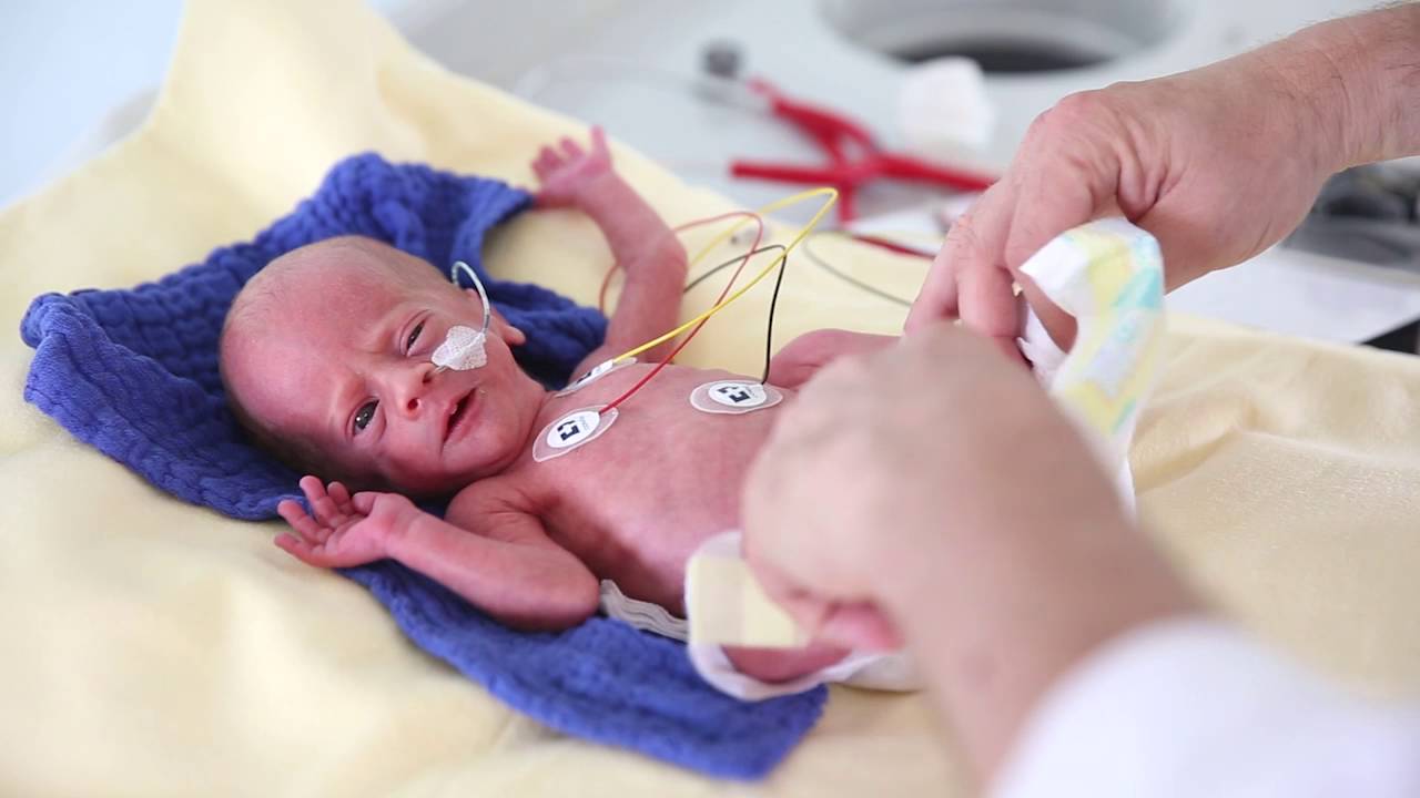 Die Neonatologie am Kantonsspital St.Gallen