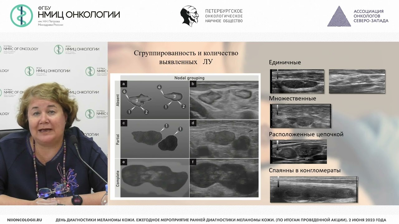 Первичная ультразвуковая диагностика меланомы кожи и метастазов меланомы кожи