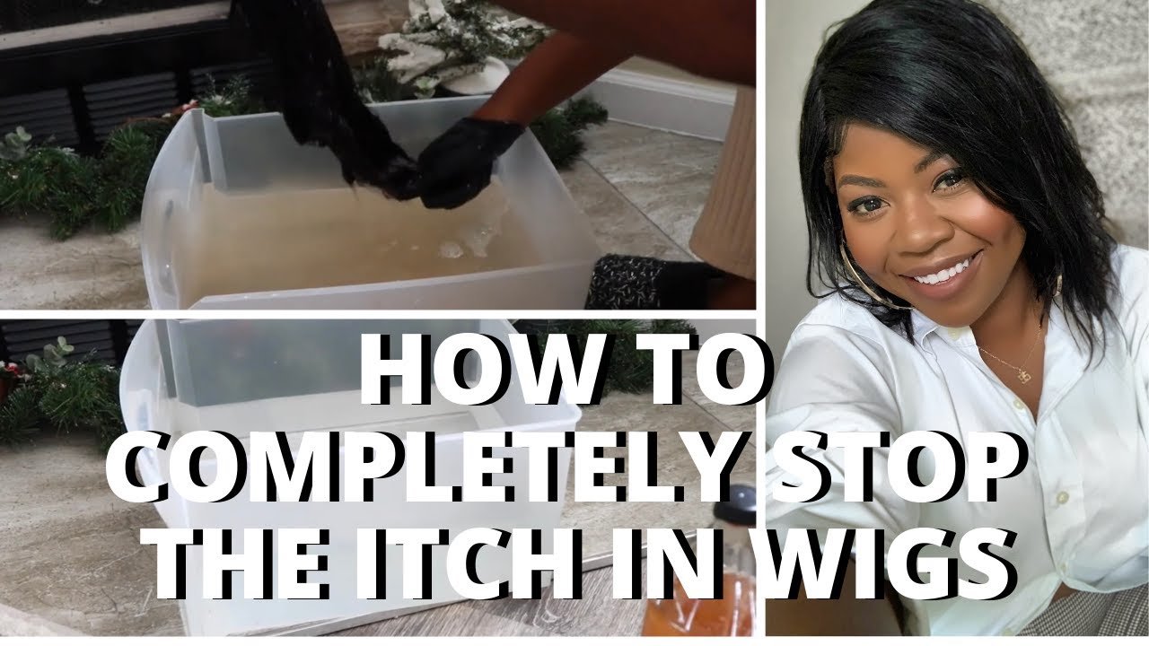 DIY: STOP ITCHING UNDER YOUR WIGS! HOW TO COMPLETELY STOP THE ITCH IN WIGS