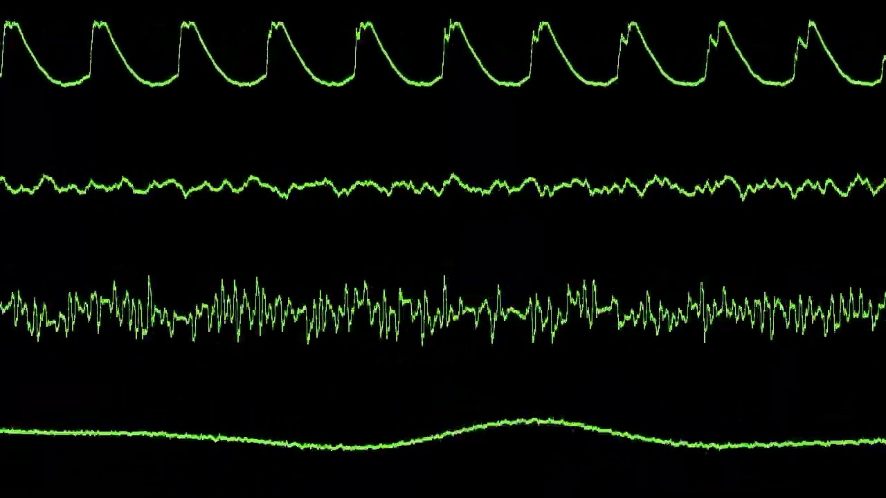 [OscView 60FPS] 4mat - 