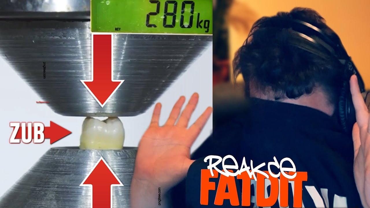 NA TOHLE SE NEMŮŽU KOUKAT