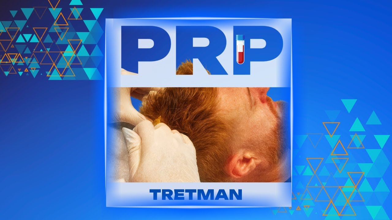 Sve što trebate znati o PRP tretmanu za jačanje kose!