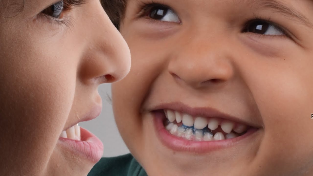 Clases III o mordida cruzada anterior en un niño de 4 años