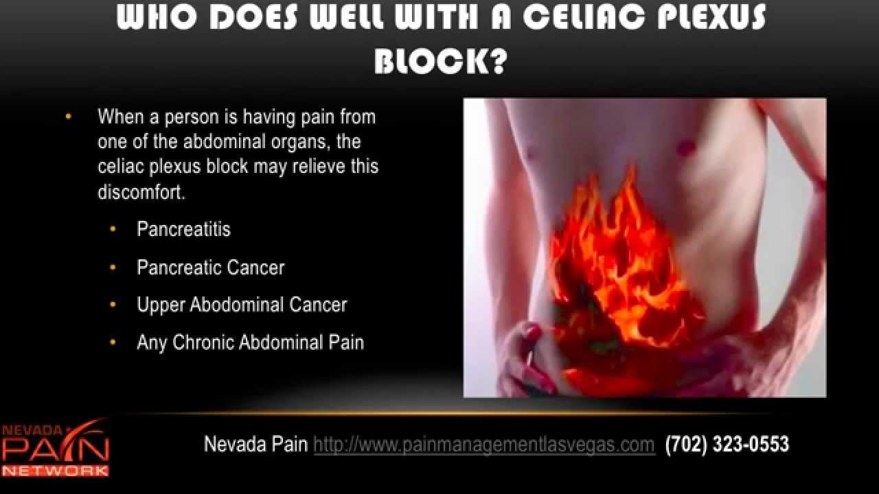Celiac Plexus Blocks for Abdominal Pain Explained by a Las Vegas Pain Clinic
