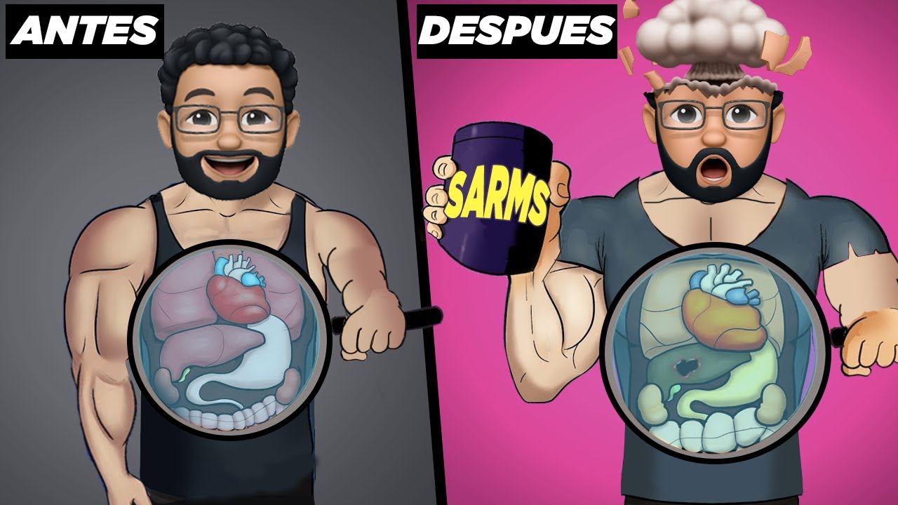 ¿Qué le pasa a tu CUERPO cuando TOMAS SARMs? - (conoce TODOS sus EFECTOS POSITIVOS y NEGATIVOS)