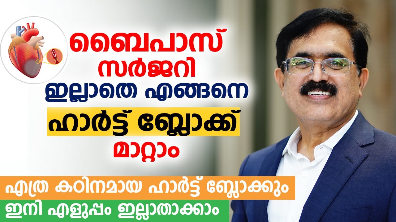 ബൈപാസ് സർജറി ഇല്ലാതെ എങ്ങനെ ഹാർട്ട് ബ്ലോക്ക് മാറ്റാം | Dr Yusuf Kumble | Heart Block Treatment