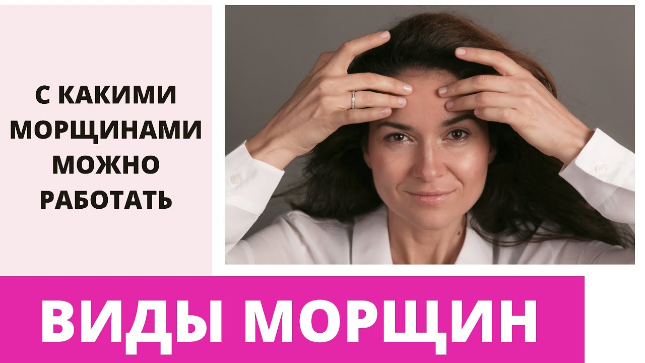 ВИДЫ МОРЩИН. Ирэн Влади