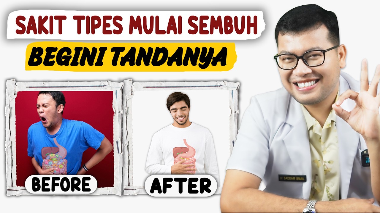 TANDA TANDA SAKIT TIPES SUDAH MULAI SEMBUH - DOKTER SADDAM ISMAIL