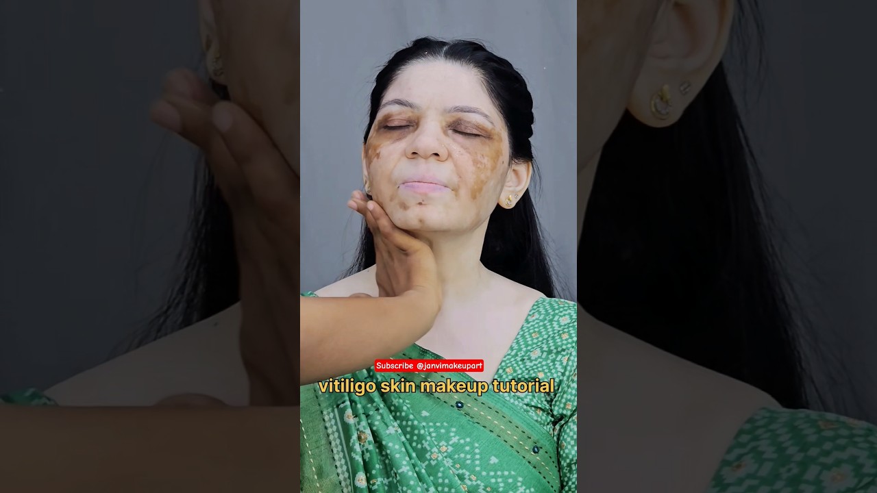 vitiligo skin makeup tutorial @janvimakeupart #vitiligomakeup #makeuptutorial #makeupclass