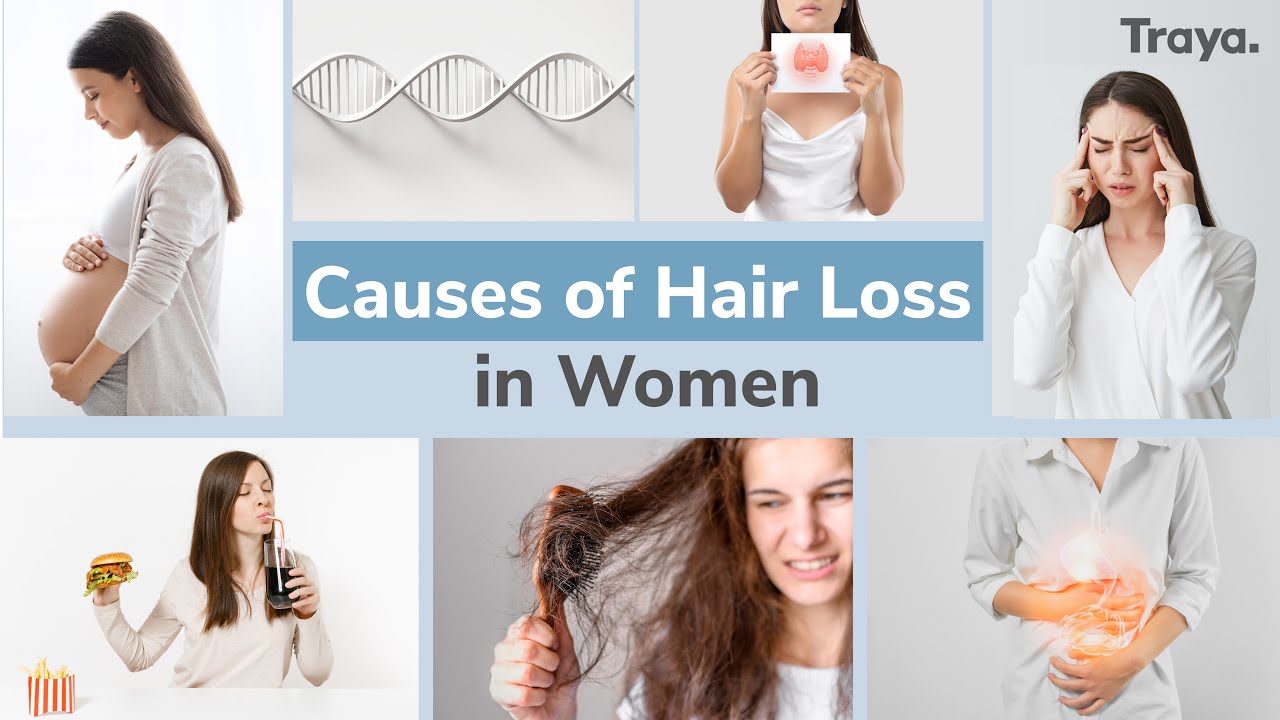 Causes of SUDDEN Hair Loss in Females -  Women's Hair Loss Explained!