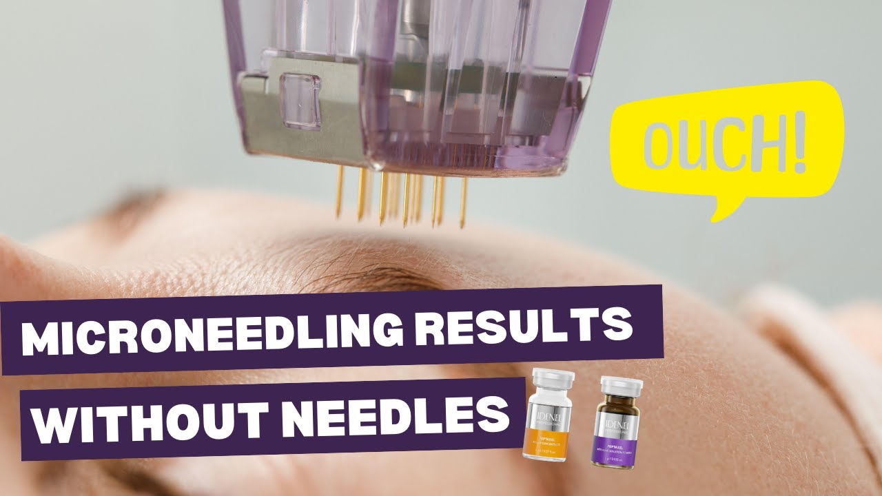 How to Get Microneedling Benefits Without the Needles