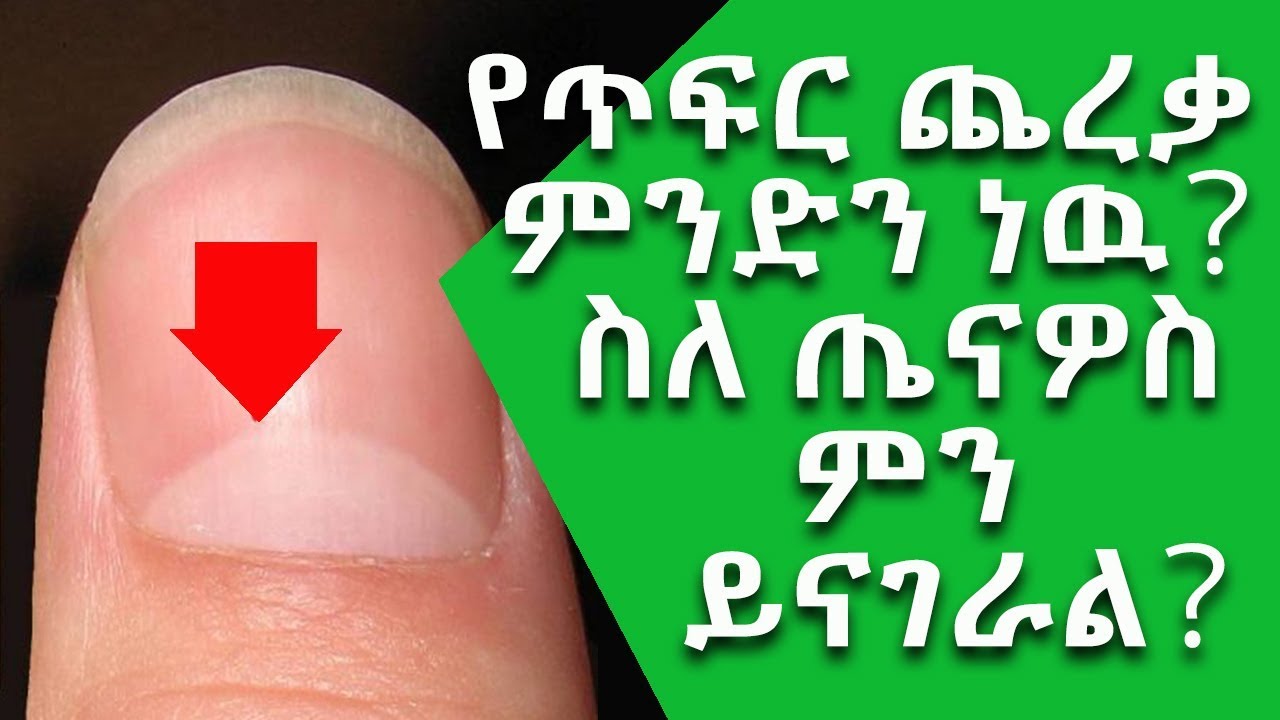 Ethiopia: የጥፍር ጨረቃ ምንድን ነው? ስለ ጤናዎስ ምን ይናገራል? || Nuro Bezede