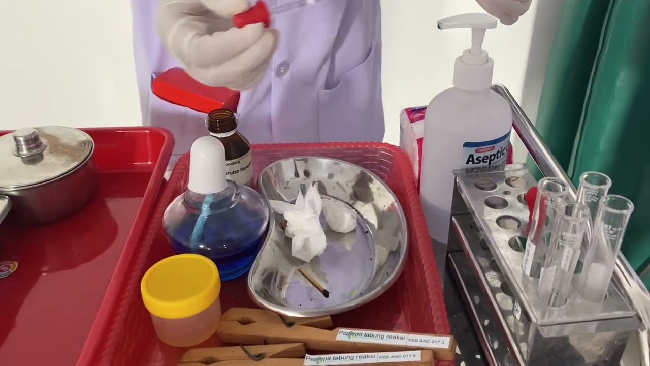 Tugas video pemeriksaan test urin glukosa darah🩸👩🏻‍⚕️
