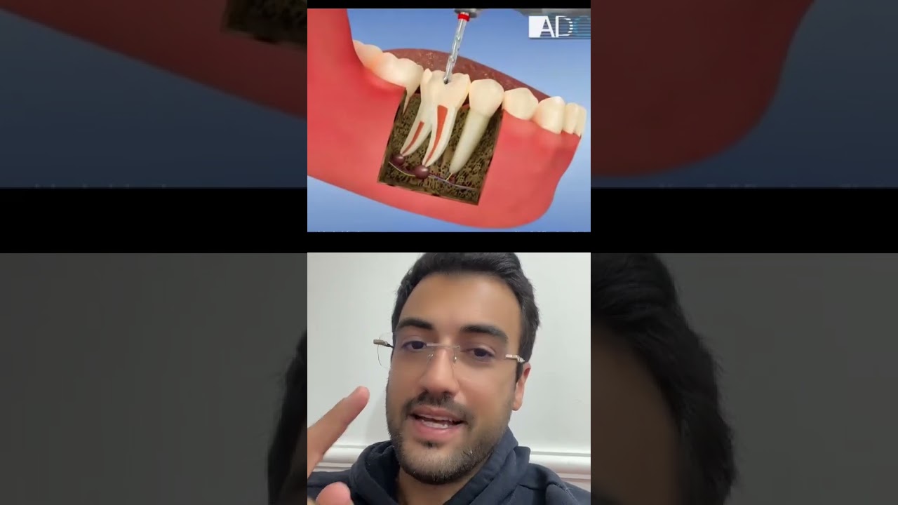 DO CANAL A COROA