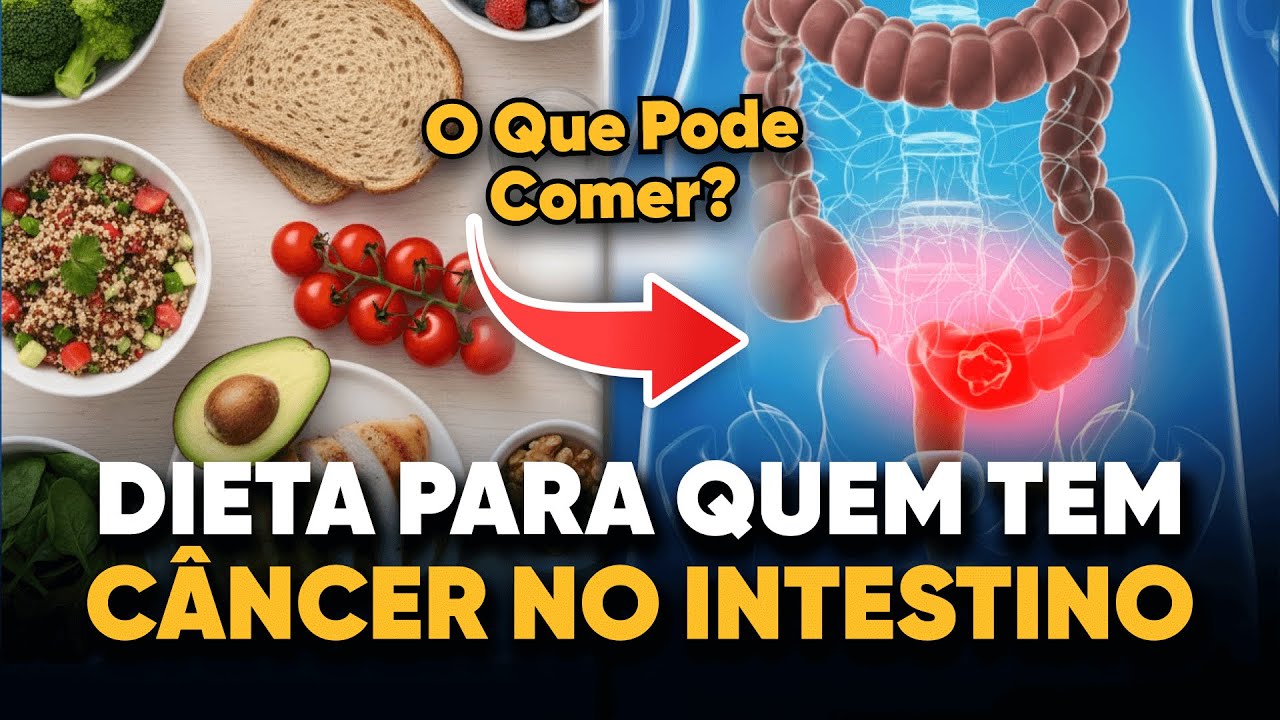 Alimentação no Câncer Colorretal: Guia Completo Para se Recuperar Melhor