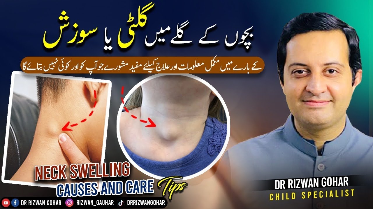 Unlock the Secrets of Neck Swelling in Kids: Expert Insights #neckswelling #lymphnodes #treatment