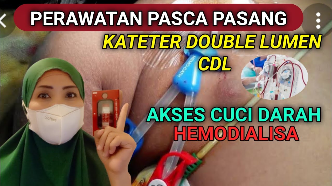 PERAWATAN PASCA PEMASANGAN KATETER DOUBLE LUMEN CDL UNTUK HEMODIALISA