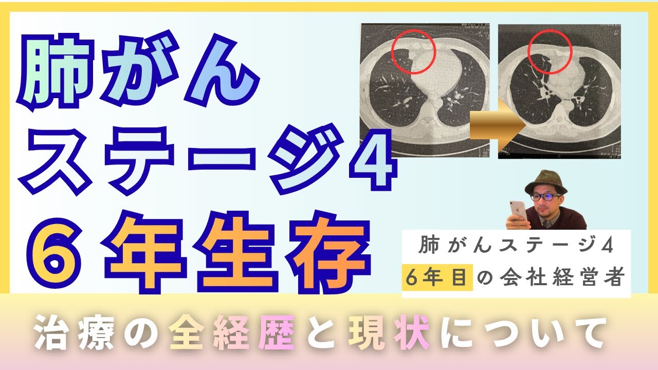 2.肺がんステージ4の治療歴と現状