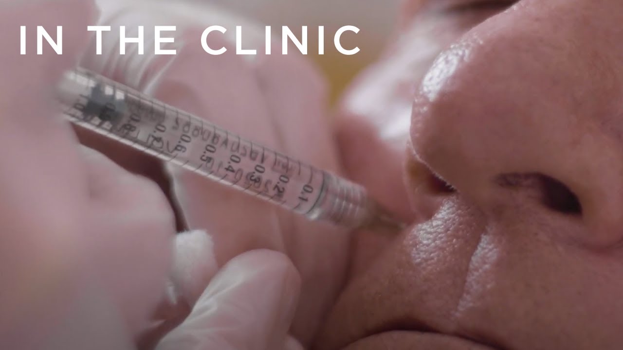 Freshen and Restore Face Volume of 60-Year-Old | In The Clinic: Before and Afters