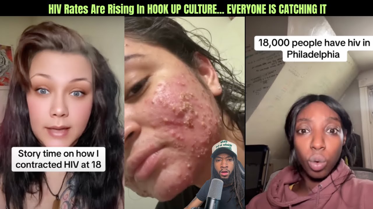 HIV Rates Are Rising In HOOK UP CULTURE... EVERYONE IS CATCHING IT