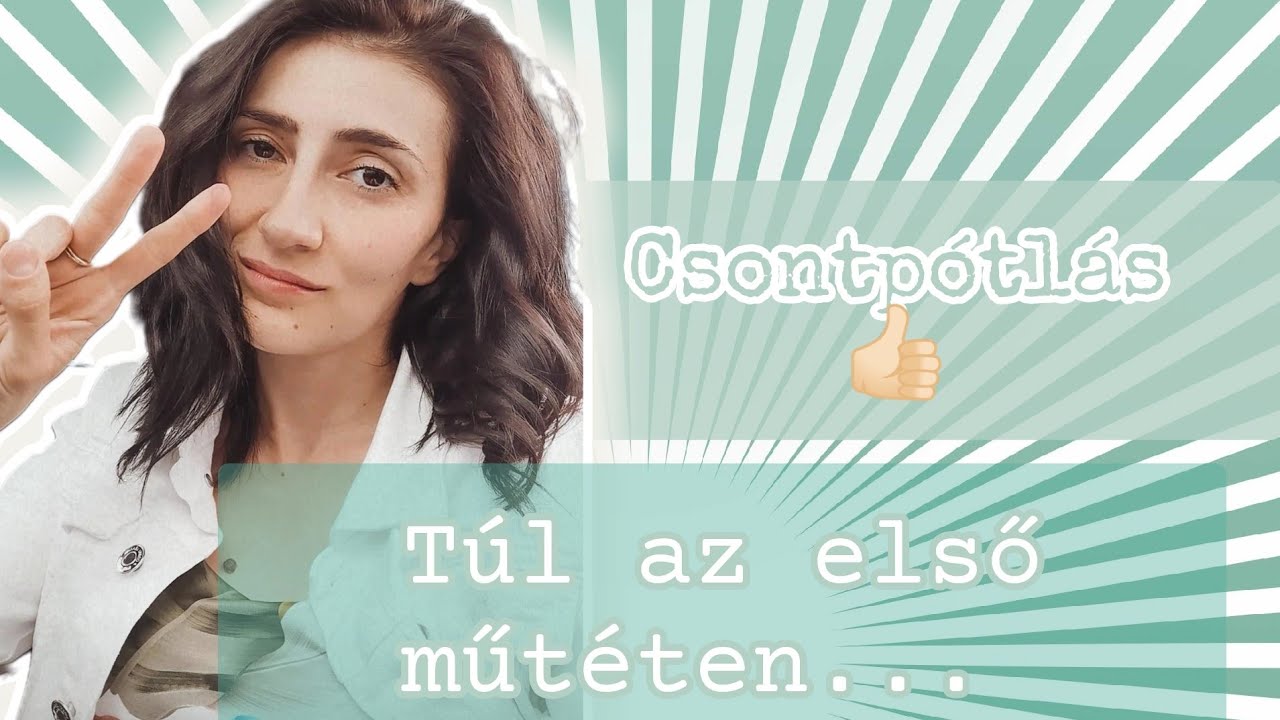 Fogsztorim 2. r&eacute;sz | Csontp&oacute;tl&aacute;s az egyik oldalon...ebből mindent megtudsz!