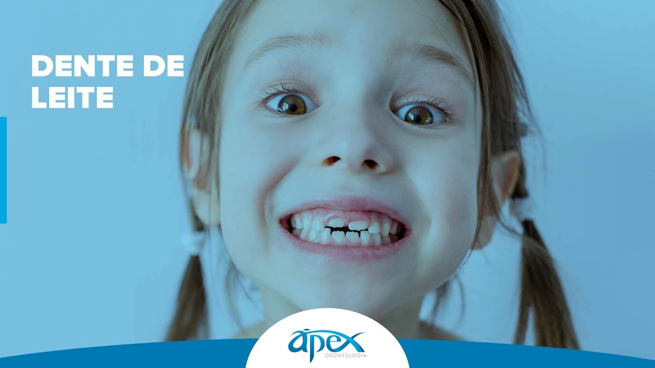 Dentes de Leite | Dra. Fulvia N. P. Caterina CRO 57052 - &Aacute;pex Odontologia