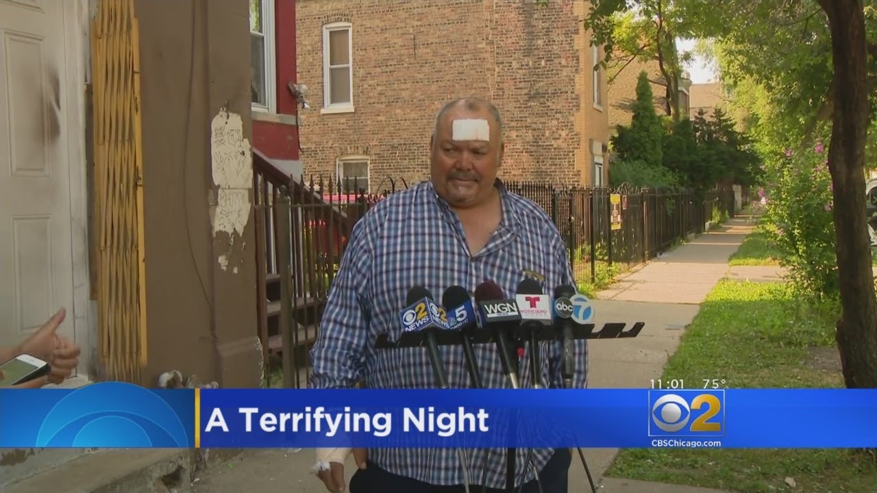 Man Grazed By Stray Bullets While Sleeping In Little Village