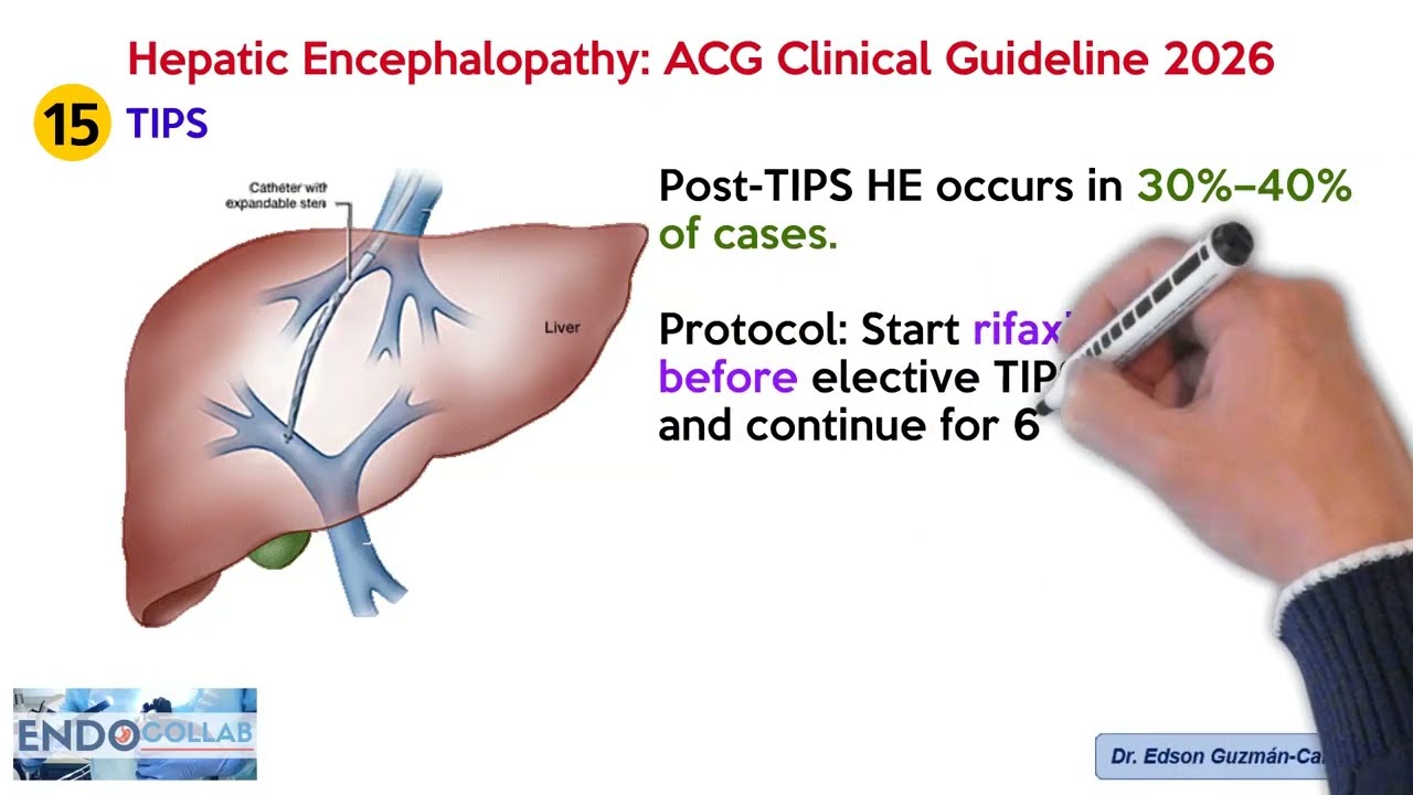 Hepatic Encephalopathy: ACG Clinical Guideline 2026