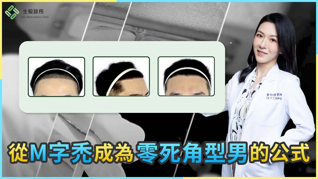 從M字禿成為零死角型男的公式｜植髮案例分享｜生髮植髮專家黃怡婷醫師