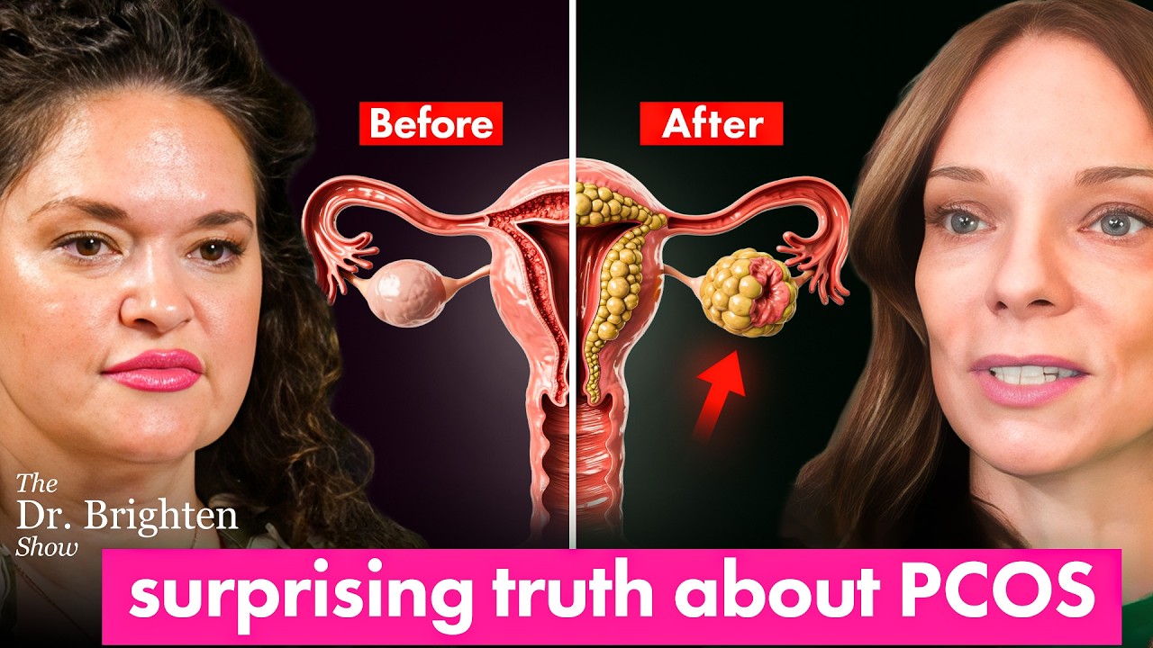Dr. Fiona McCulloch shares about Insulin, Genetics & Why PCOS Symptoms Get Worse After 30