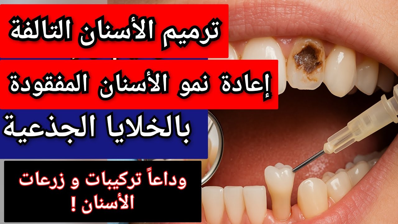 ترميم الأسنان التالفة و إعادة نمو الأسنان المفقودة بالخلايا الجذعية. وداعاً زرعات و تركيبات الأسنان!