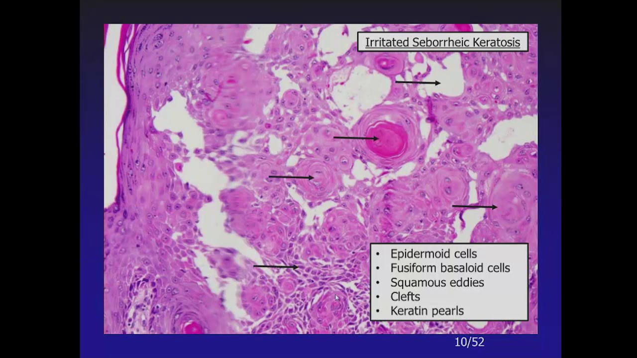 Oakstone pathology DEMO