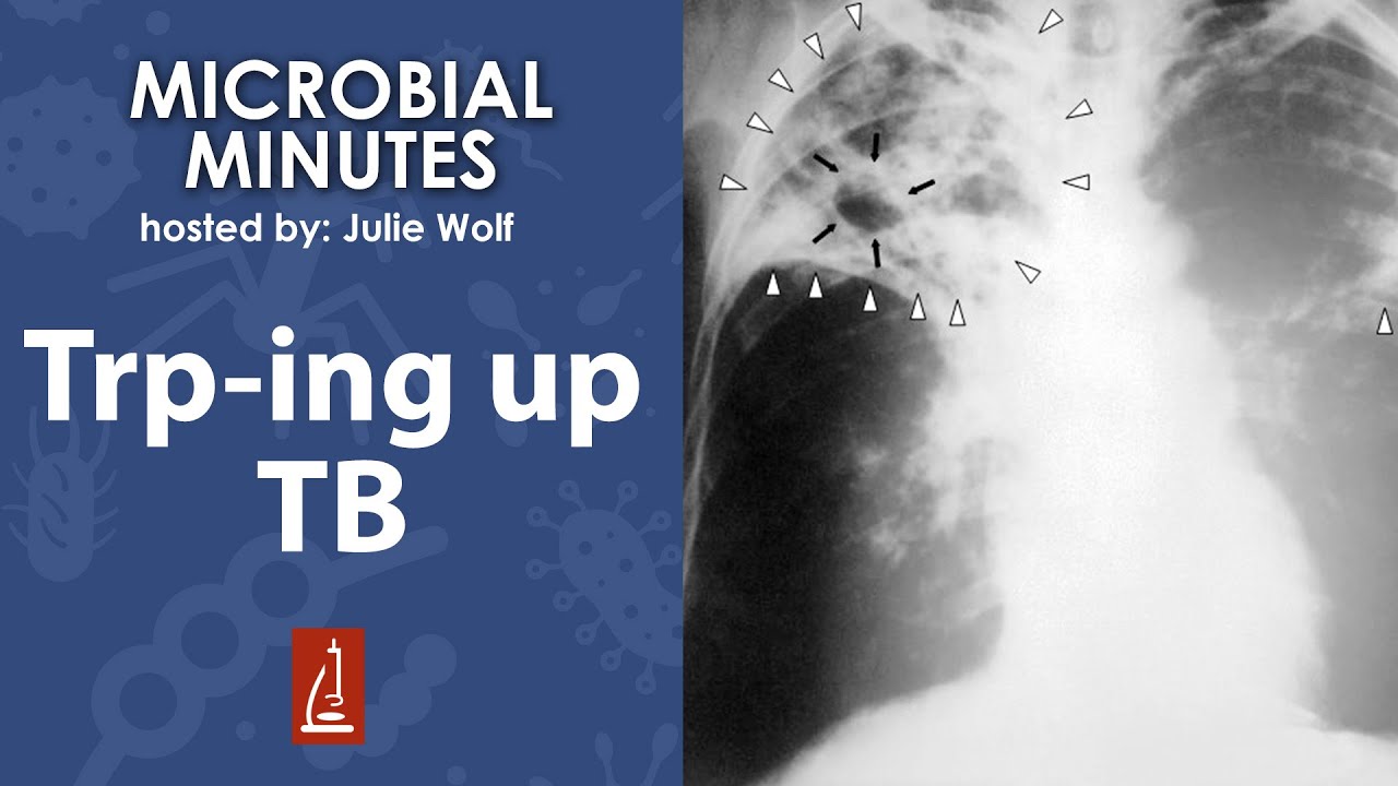 How a gut microbiota product can treat TB