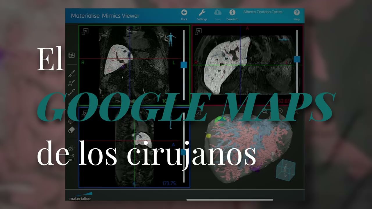 Así es el «Google Maps» de los cirujanos